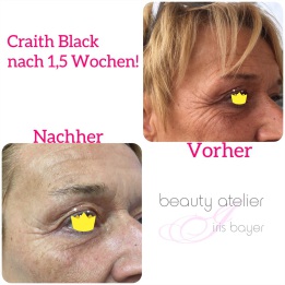 Sauerstoff Behandlung Qms Kosmetik Beauty Atelier Iris Bayer in 85551 Kirchheim bei München