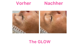 Sauerstoff Behandlung Qms Kosmetik Beauty Atelier Iris Bayer in 85551 Kirchheim bei München